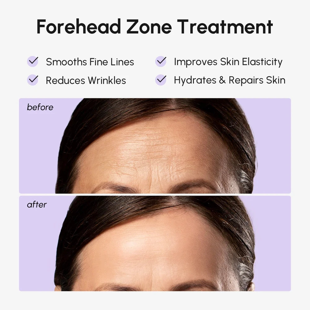 Marée® Anti-Wrinkle Forehead Patches — Overnight Smoothing Treatment