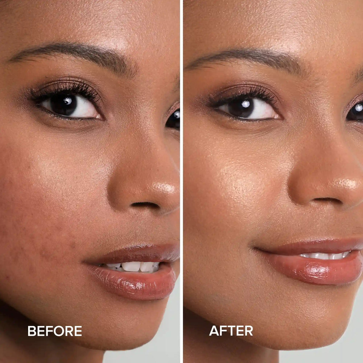 Marée® Turmeric Kojic Soap & Scrub